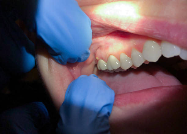 Best Urgent Dental Care for Toothaches in Pine Nyon, CA