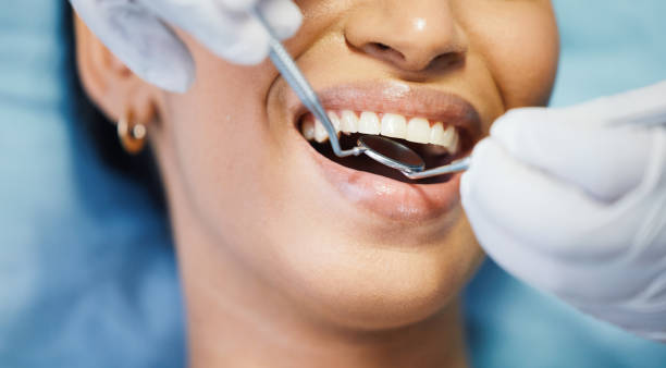 Best Emergency Cosmetic Dentistry (e.g., broken veneers) in Pine Nyon, CA