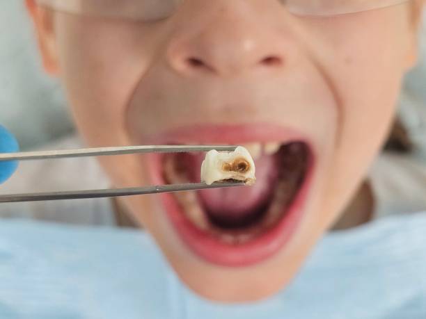  Pine Nyon, CA Emergency Dentist Pros